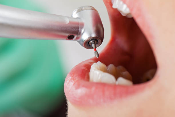 Best Tooth Infection Emergency Dentist  in Carol Stream, IL